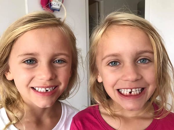 Mirror Twins, showing off their mirrored teeth patterns, blond haired girls with blue eyes.